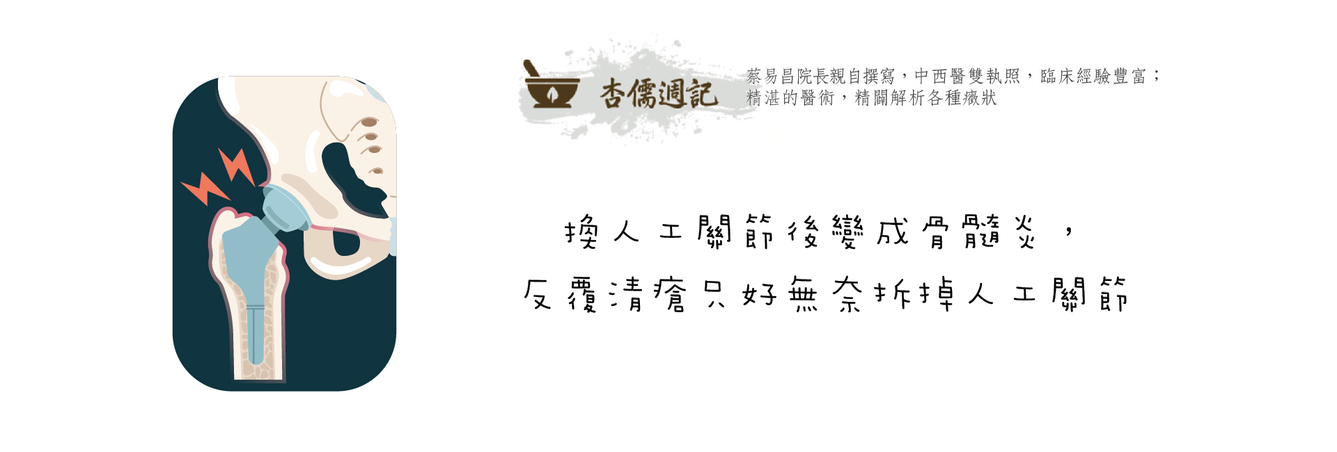 換人工關節後變成骨髓炎，反覆清瘡只好無奈